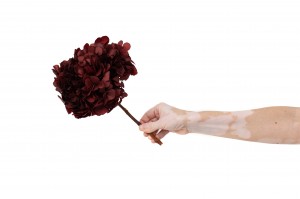 hortensia-stabilise-14.