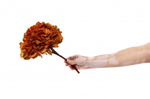 hortensia-stabilise-14.