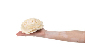 kohlrose-auf-sockel-sola-blume-29.